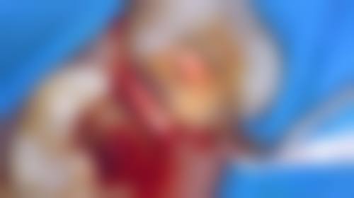 佛山牙友口腔大沥钟边门诊擅长项目有哪些？