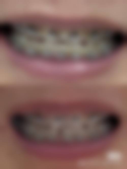 赵江擅长项目列表