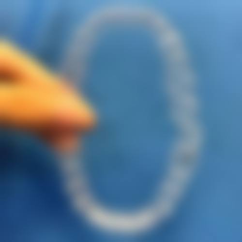 伍芳芳患者评价