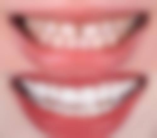 鄂州市花湖春芽口腔诊所技术设备怎么样？