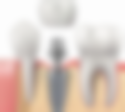 毕节市利民口腔2026价格表参考