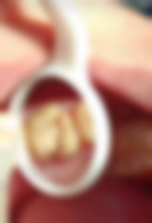 北京大学口腔医院口腔预防保健科口碑评价