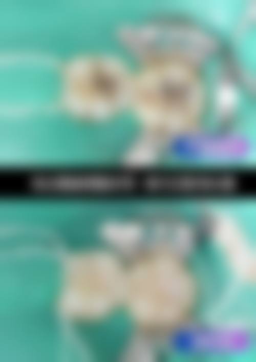 北京西小口口腔门诊部2026价格表参考