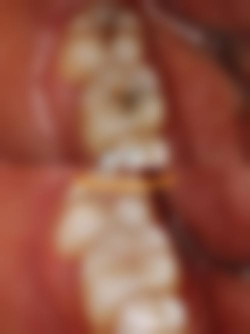 东莞爱雅健口腔连锁(新世纪星城店)技术设备怎么样？