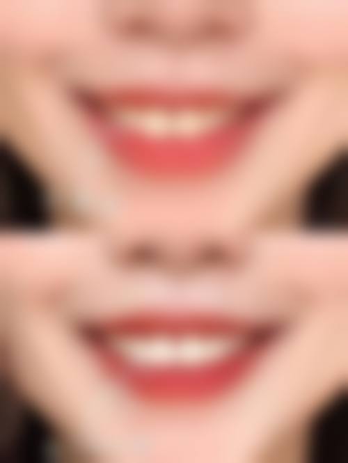 北京西小口口腔门诊部医生团队解析