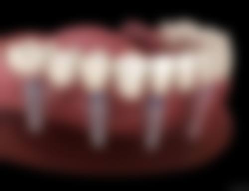 北海同步口腔(宁春城门诊)擅长项目有哪些?