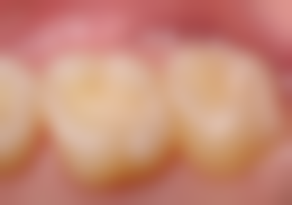 绍兴皓博士口腔口碑评价