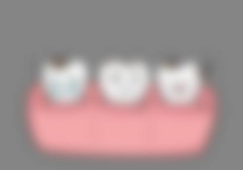 山东菏泽巨野百乐口腔2026价格表参考