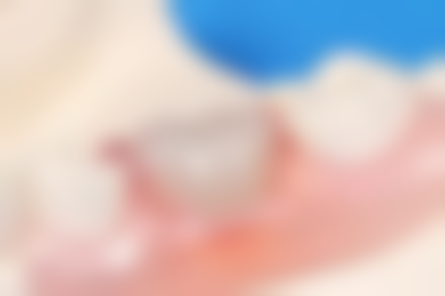 深圳市同步齿科医疗股份有限公司同雅口腔门诊部医生团队解析