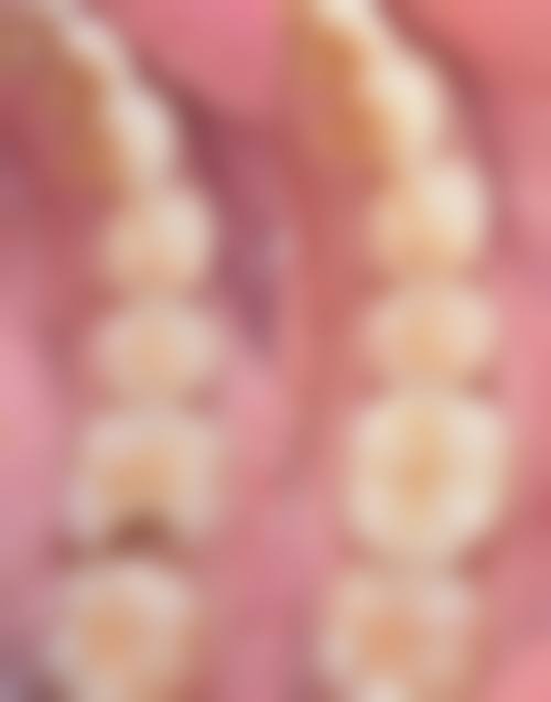 山东菏泽巨野百乐口腔技术设备怎么样？