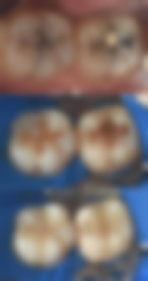 济南泰康拜博贝斯特口腔医院擅长项目有哪些？