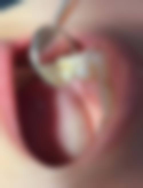 深圳汪洋口腔诊所交通攻略