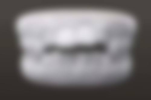 惠州理想口腔门诊部医生团队解析