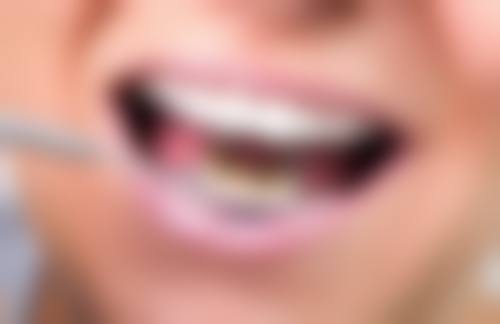 陈云芳患者评价