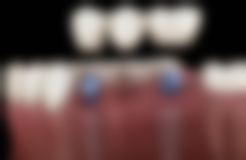 西安瑞泰口腔医院地址及到院路线