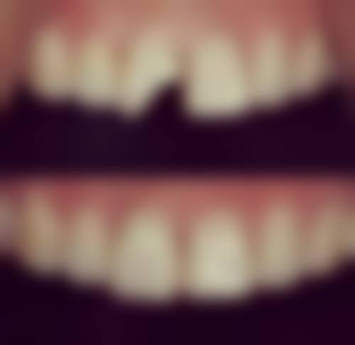 咸阳兴平贝齿口腔擅长项目有哪些？