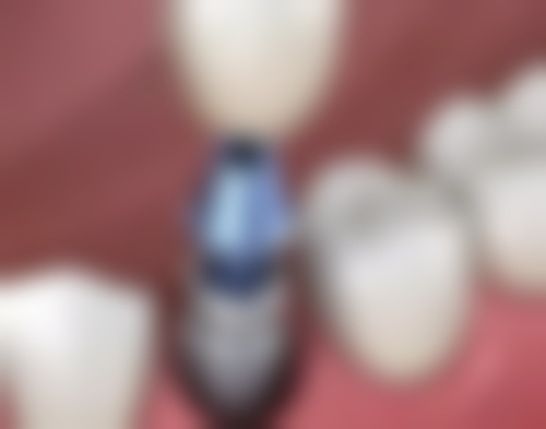 西安瑞泰口腔医院地址及到院路线