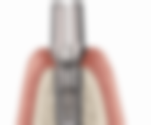 罗明预约方式及价格表