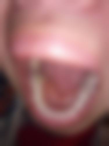 陕西延安健康口腔诊所2026价格表参考