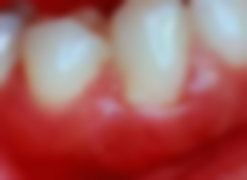 河南南阳方城万超口腔诊所2026年看牙补贴指南