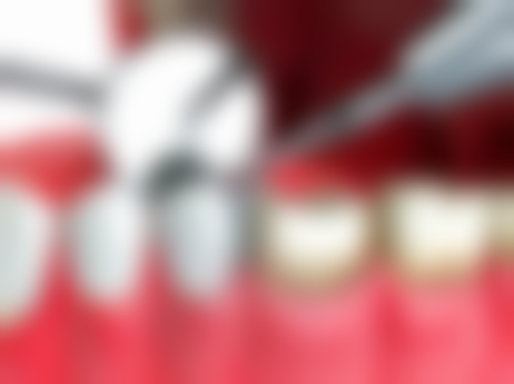 河南南阳方城万超口腔诊所收费透明吗?附价格参考