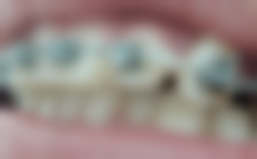 吴健雄患者评价