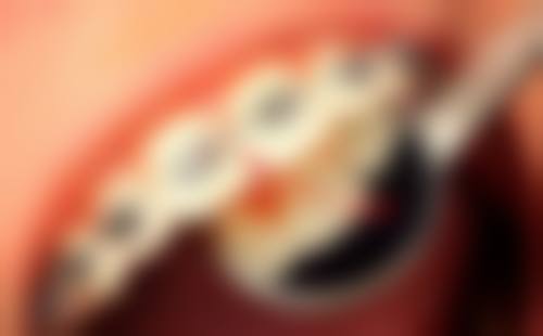 北京康博乐口腔门诊部医生团队解析