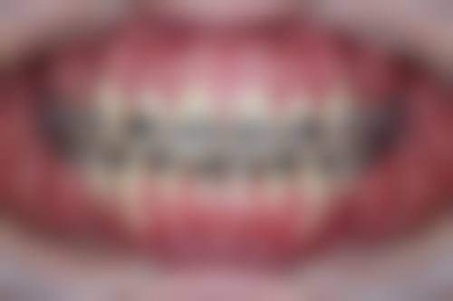 北京康博乐口腔门诊部擅长项目有哪些？