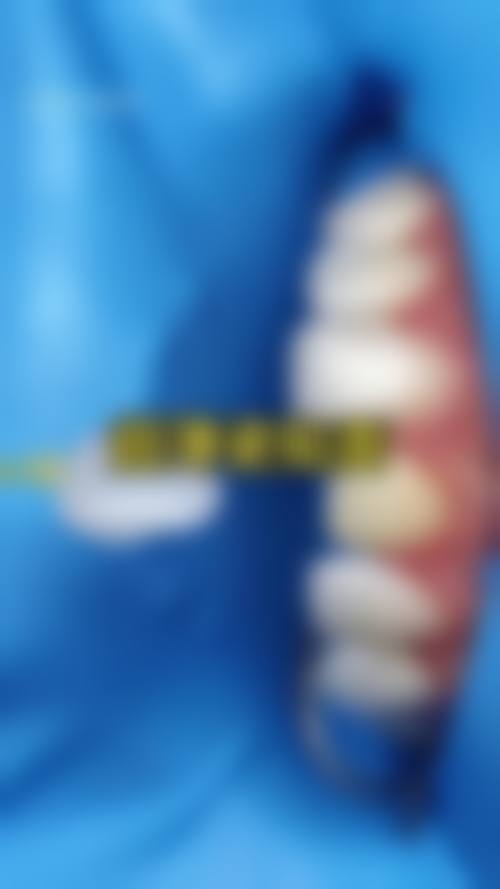 东莞麻涌维尔口腔门诊2026价格表参考