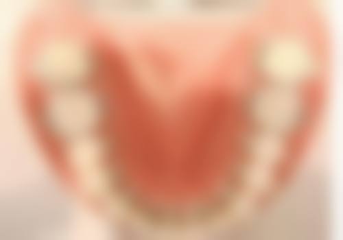 济宁超凡口腔医院擅长项目有哪些？