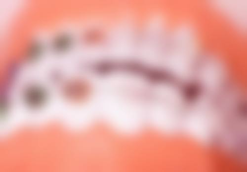 刘淑艳擅长项目列表