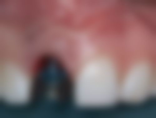 山东德州武城婧文口腔诊所擅长项目有哪些?