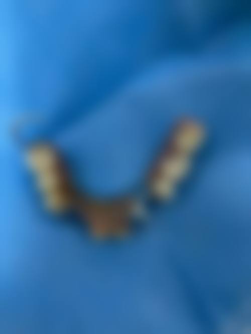 正植口腔门诊部擅长项目有哪些？