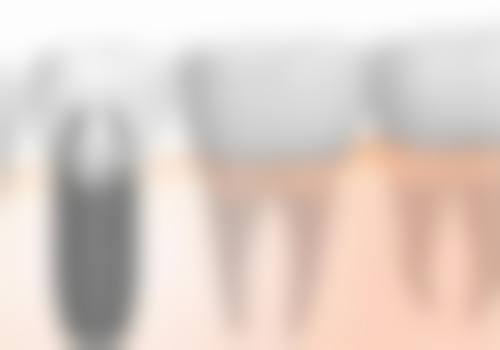 可恩口腔医院(市中分院)擅长项目有哪些?