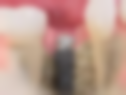 东莞市第五人民医院口腔科口碑评价