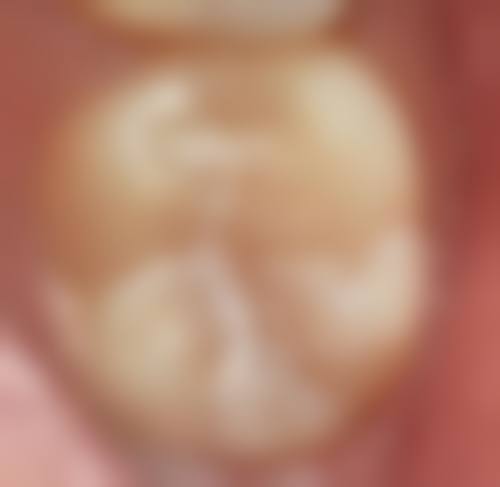 北京溪美康北苑口腔门诊部擅长项目有哪些？