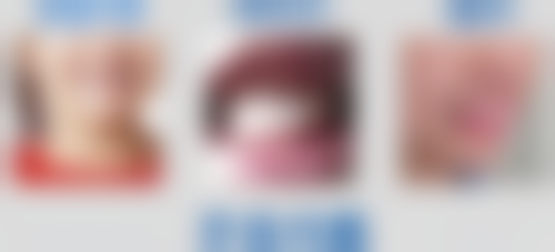 武汉百瑞景口腔诊所地址及到院路线