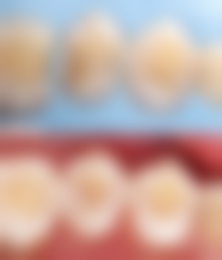 大连拜博口腔医院2026价格表参考