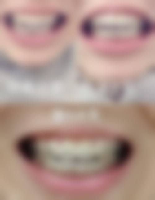 江西赣州乐雅口腔擅长项目有哪些？