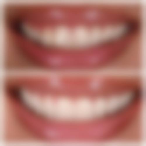 上海泰康拜博口腔(长宁区分院)医生团队解析