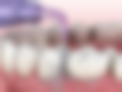 江西赣州乐雅口腔2026价格表参考