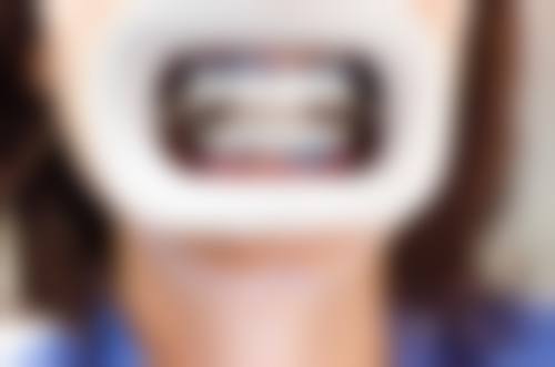 深圳优梨口腔门诊交通攻略