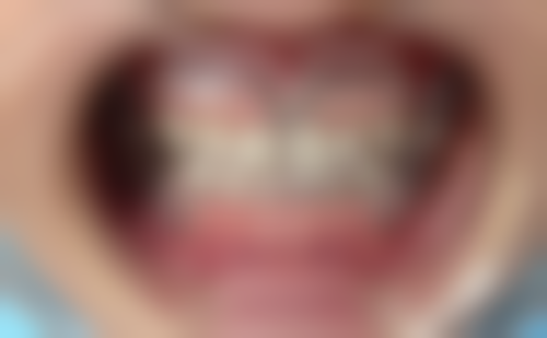 袁小莉预约方式及价格表