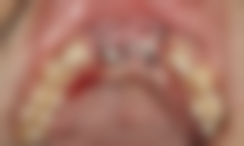 平阴佳冠口腔擅长项目有哪些？