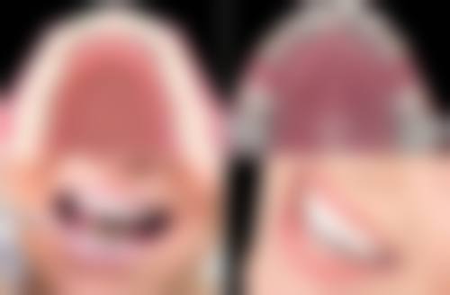 西安林牙立齿口腔擅长项目有哪些？