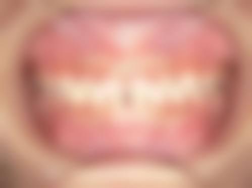 西安林牙立齿口腔医生团队解析