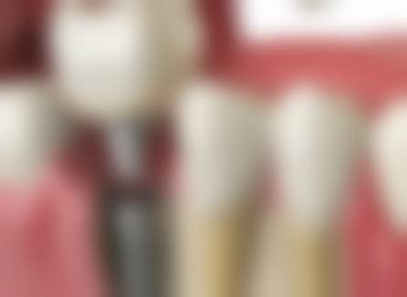 伍芳芳患者评价