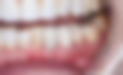 瑶海美雅尔口腔门诊部口碑评价