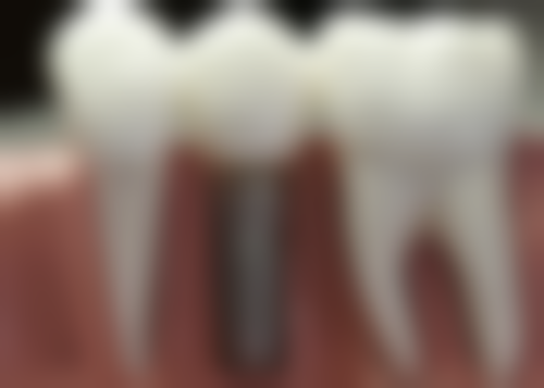 东莞万江凯美口腔门诊医生团队解析