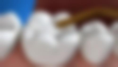 宁波鄞州口腔医院擅长项目有哪些？